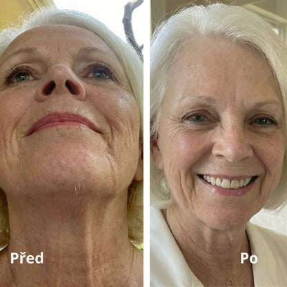 Lorvea Cyperus — Olej proti růstu chloupků