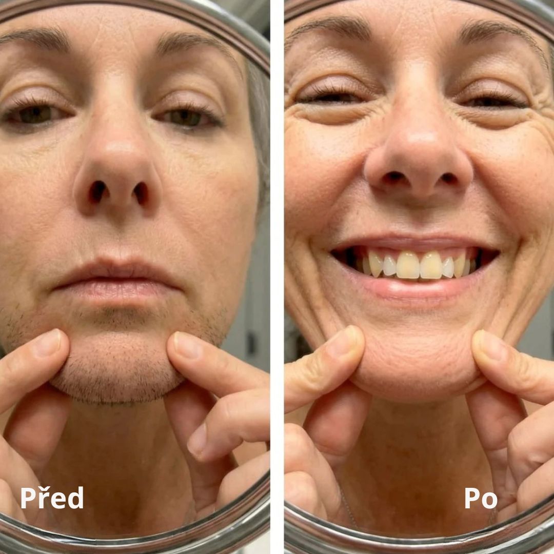 Lorvea Cyperus — Olej proti růstu chloupků